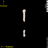 lucy humerus medial view